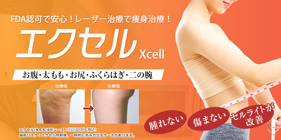 Xcell（エクセル）症例数多数！船橋中央&青山セレスクリニックのエクセル　切らずに、痛まずに、脂肪解消！セルライト解消！